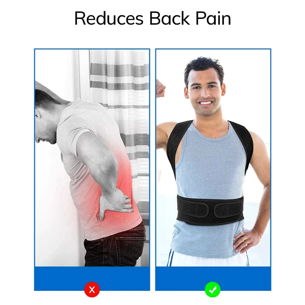 Back Brace Posture Corrector – Adjustable Support for Men & Women