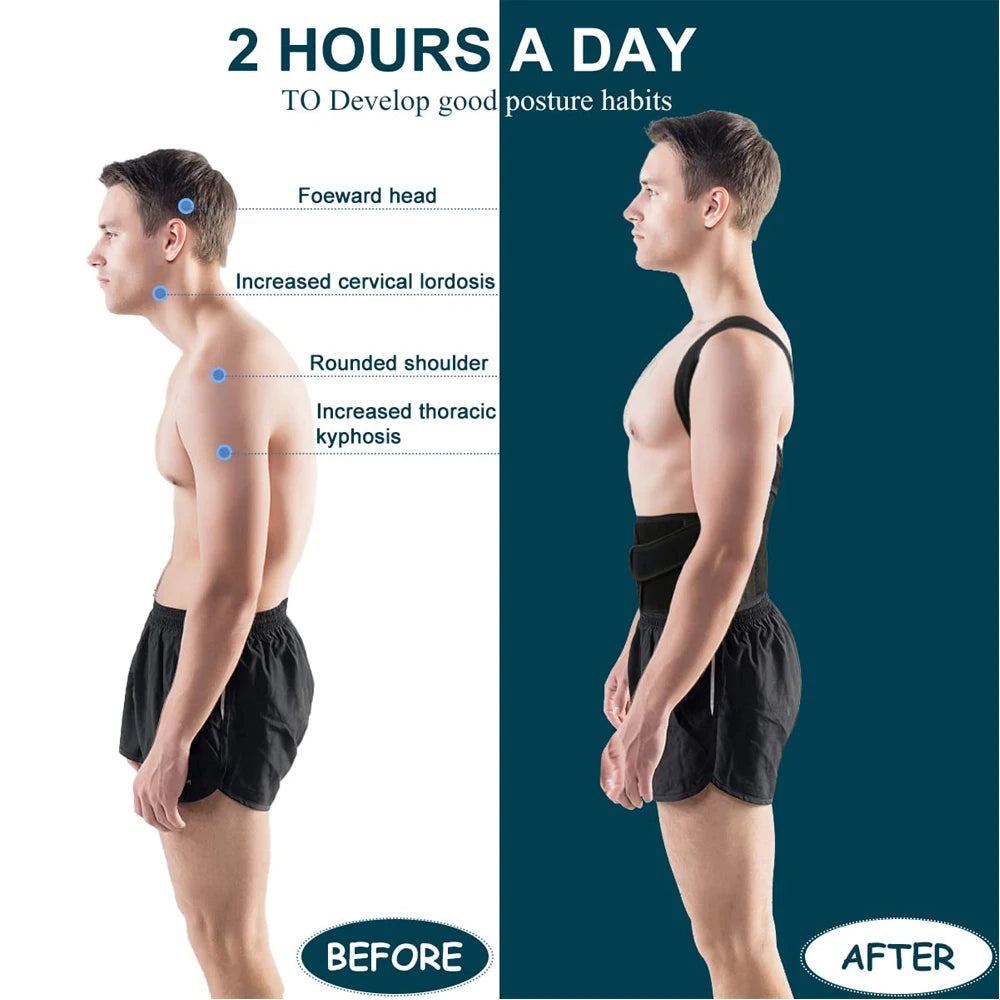 Back Brace Posture Corrector – Adjustable Support for Men & Women
