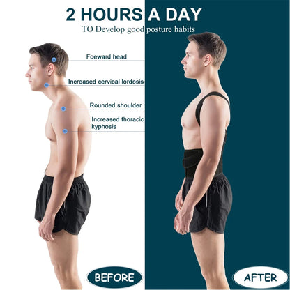 Back Brace Posture Corrector – Adjustable Support for Men & Women